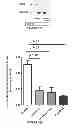 Fig. 09 - Methods of using AMPD2 inhibitors for the treatment of fatty liver, obesity and diabetes