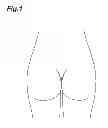Fig. 02 - Bottom clothes