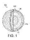 Fig. 02 - Golf ball with high density and high hardness mantle