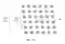 Fig. 03 - FETAL ANEUPLOIDY DETECTION BY SEQUENCING