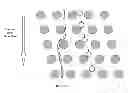 Fig. 04 - FETAL ANEUPLOIDY DETECTION BY SEQUENCING