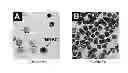 Fig. 13 - FETAL ANEUPLOIDY DETECTION BY SEQUENCING