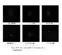 Fig. 14 - FETAL ANEUPLOIDY DETECTION BY SEQUENCING