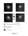 Fig. 15 - FETAL ANEUPLOIDY DETECTION BY SEQUENCING