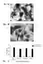 Fig. 02 - METHODS FOR TREATING INFECTION