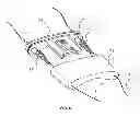 Fig. 07 - Fastening device for orthoses