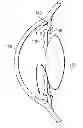 Fig. 01 - Pressure-driven membrane valve for pressure control system