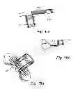 Fig. 07 - Device, A Kit And A Method For Treatment Of Disorders In The Heart Rhythm Regulation System