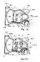 Fig. 08 - Device, A Kit And A Method For Treatment Of Disorders In The Heart Rhythm Regulation System