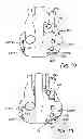 Fig. 09 - Device, A Kit And A Method For Treatment Of Disorders In The Heart Rhythm Regulation System