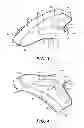 Fig. 04 - Method for reducing contamination of surgical site