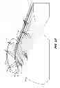 Fig. 22 - Method for reducing contamination of surgical site