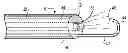 Fig. 01 - SYSTEM AND METHOD FOR DELIVERING AN ANTI-ADHESIVE SUBSTANCE TO A BODY CAVITY