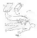 Fig. 02 - SYSTEM AND METHOD FOR DELIVERING AN ANTI-ADHESIVE SUBSTANCE TO A BODY CAVITY