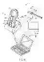 Fig. 02 - Systems and methods for treating chronic liver failure based on peritoneal dialysis