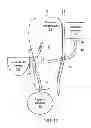 Fig. 04 - Systems and methods for treating chronic liver failure based on peritoneal dialysis