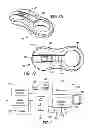 Fig. 12 - Systems and methods for treating chronic liver failure based on peritoneal dialysis