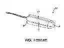 Fig. 02 - Tampon with segmented grooves