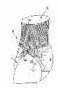 Fig. 01 - INCONTINENCE ARTICLE IN THE FORM OF BRIEFS