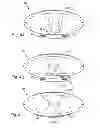Fig. 09 - Convertible absorbent article