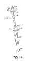Fig. 02 - Surgical tools facilitating increased accuracy, speed and simplicity in performing joint arthroplasty