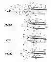 Fig. 07 - Ligation device and clip unit used therein