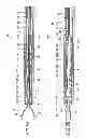 Fig. 09 - Ligation device and clip unit used therein