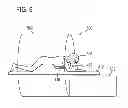 Fig. 07 - THERAPEUTIC APPARATUS, COMPUTER-IMPLEMENTED METHOD, AND COMPUTER PROGRAM PRODUCT FOR CONTROLLING THE FOCUS OF RADIATION INTO A MOVING TARGET ZONE