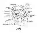 Fig. 02 - Methods, Systems and Devices for Treatment of Cerebrospinal Venous Insufficiency and Multiple Sclerosis