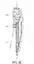 Fig. 06 - Endoprosthesis having aligned legs for ease of cannulation