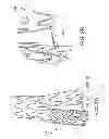 Fig. 07 - Endoprosthesis having aligned legs for ease of cannulation