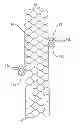Fig. 01 - Apparatus and method for deploying an implantable device within the body