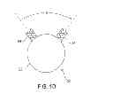 Fig. 04 - Apparatus and method for deploying an implantable device within the body