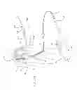 Fig. 33 - Apparatus and method for deploying an implantable device within the body