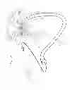 Fig. 35 - Apparatus and method for deploying an implantable device within the body