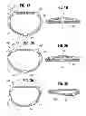 Fig. 02 - Flexible annuloplasty ring