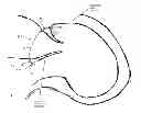 Fig. 01 - Method and apparatus for repairing a mitral valve