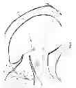 Fig. 06 - Method and apparatus for repairing a mitral valve