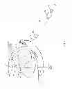 Fig. 07 - Method and apparatus for repairing a mitral valve