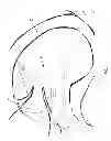 Fig. 08 - Method and apparatus for repairing a mitral valve