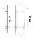 Fig. 06 - Hermetically sealed implantable ophthalmic devices and methods of making same