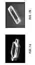 Fig. 09 - Hermetically sealed implantable ophthalmic devices and methods of making same