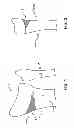 Fig. 02 - Wedge shaped fracture fixation devices and methods for using the same