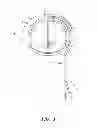 Fig. 02 - Cam lock burr hole plug for securing stimulation lead