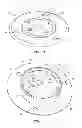 Fig. 04 - Cam lock burr hole plug for securing stimulation lead