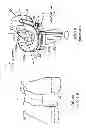 Fig. 05 - PATIENT-ADAPTED AND IMPROVED ARTICULAR IMPLANTS, DESIGNS AND RELATED GUIDE TOOLS