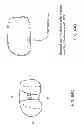Fig. 101 - PATIENT-ADAPTED AND IMPROVED ARTICULAR IMPLANTS, DESIGNS AND RELATED GUIDE TOOLS