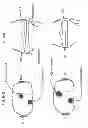 Fig. 102 - PATIENT-ADAPTED AND IMPROVED ARTICULAR IMPLANTS, DESIGNS AND RELATED GUIDE TOOLS