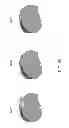 Fig. 103 - PATIENT-ADAPTED AND IMPROVED ARTICULAR IMPLANTS, DESIGNS AND RELATED GUIDE TOOLS