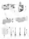 Fig. 112 - PATIENT-ADAPTED AND IMPROVED ARTICULAR IMPLANTS, DESIGNS AND RELATED GUIDE TOOLS